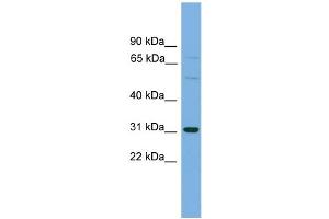 WB Suggested Anti-SLCO1B1 Antibody Titration: 0. (SLCO1B1 antibody  (Middle Region))