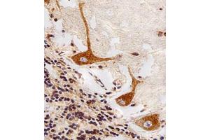 Immunohistochemical staining of paraffin-embedded human cerebellum section reacted with PPT1 monoclonal antibody  at 1:25 dilution. (PPT1 antibody)
