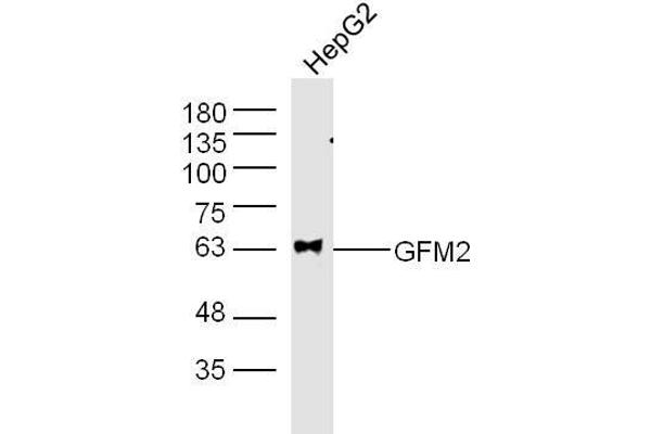 GFM2 Antikörper  (AA 151-250)
