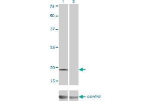 Western Blotting (WB) image for anti-DCMP Deaminase (DCTD) (AA 69-178) antibody (ABIN560576)