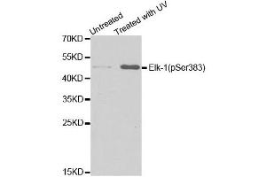 Western blot analysis of extracts from HT29 cells untreated or treated with UV, using Phospho-ELK1-S383 antibody (ABIN5969890).