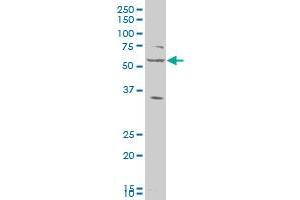 LAP3 polyclonal antibody (A01), Lot # FHC4060725QCS1 Western Blot analysis of LAP3 expression in HeLa . (LAP3 antibody  (AA 420-519))