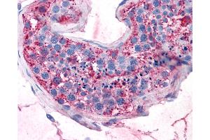 Anti-GPRC5A / RAI3 antibody IHC of human testis. (GPRC5A antibody  (Transmembrane Domain))