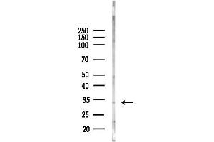 anti-Menage A Trois Homolog 1, Cyclin H Assembly Factor (Xenopus Laevis) (MNAT1) (N-Term) antibody