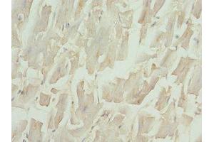 IHC analysis of paraffin-embedded human heart tissue, using NT-proBNP antibody (1/100 dilution). (NT-ProBNP antibody  (AA 27-102))