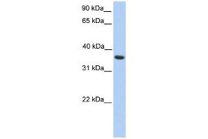 MAGEA4 antibody used at 1 ug/ml to detect target protein.