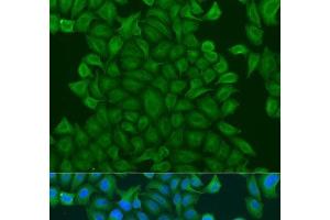 Immunofluorescence analysis of U2OS cells using GSTM3 Polyclonal Antibody at dilution of 1:100. (GSTM3 antibody)