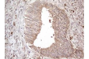 Immunohistochemistry (IHC) image for anti-Amelotin (AMTN) antibody (ABIN2716039) (Amelotin antibody)