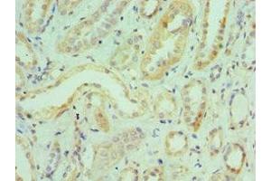 Immunohistochemistry of paraffin-embedded human kidney tissue using ABIN7156720 at dilution of 1:100 (Interleukin enhancer-binding factor 3 (ILF3) (AA 785-894) antibody)