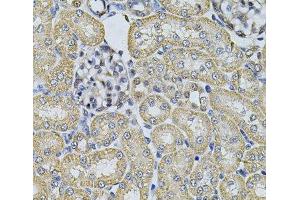 Immunohistochemistry of paraffin-embedded Rat kidney using AP2A1 Polyclonal Antibody at dilution of 1:100 (40x lens). (alpha Adaptin antibody)