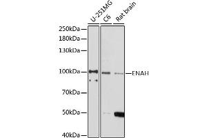 Western blot analysis of extracts of various cell lines, using ENAH antibody (ABIN7266936) at 1:1000 dilution. (ENAH antibody  (AA 412-591))