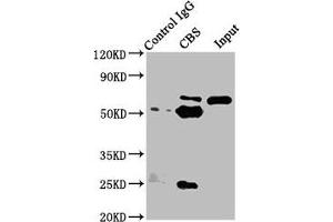 Immunoprecipitating CBS in Hela whole cell lysate Lane 1: Rabbit control IgG instead of ABIN7148965 in Hela whole cell lysate. (CBS antibody  (AA 1-413))