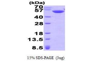 SDS-PAGE (SDS) image for Calsequestrin 2 (CASQ2) (AA 20-399) protein (His tag) (ABIN666959) (CASQ2 Protein (AA 20-399) (His tag))