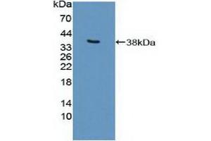 Detection of Recombinant EP300, Human using Polyclonal Antibody to E1A Binding Protein P300 (EP300)