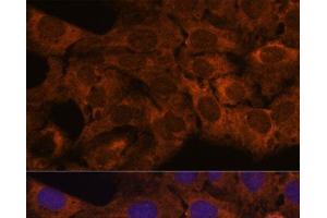 Immunofluorescence analysis of U-2 OS cells using SEC23B Polyclonal Antibody at dilution of 1:100. (Sec23 Homolog B antibody)