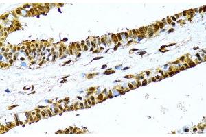 Immunohistochemistry of paraffin-embedded Human breast using NFkB p100 / p52 Polyclonal Antibody at dilution of 1:100 (40x lens). (NFKB2 antibody)