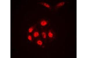Immunofluorescent analysis of SAE1 staining in A431 cells. (SAE1 antibody  (Center))