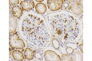 Immunohistochemistry of paraffin-embedded human kidney using SLC2A1 antibody (ABIN5997113) at dilution of 1/100 (40x lens).