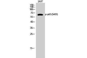 Western Blotting (WB) image for anti-T-Complex 1 (TCP1) (pSer455) antibody (ABIN3182583) (TCP1 alpha/CCTA antibody  (pSer455))