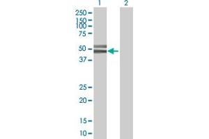 Western Blot analysis of CCNA2 expression in transfected 293T cell line by CCNA2 MaxPab polyclonal antibody.