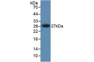 Figure. (PRSS1 antibody  (AA 51-228))