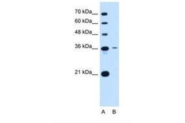 Tetraspanin 5 anticorps  (AA 175-224)
