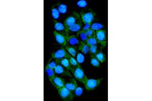 IF analysis of TTK using anti-TTK antibody (ABIN7601844). (Mps1 antibody  (AA 487-821))