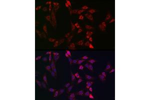 Immunofluorescence analysis of NIH-3T3 cells using Bid Rabbit pAb (ABIN3020687, ABIN3020688, ABIN3020689, ABIN1512634 and ABIN6213669) at dilution of 1:150 (40x lens). (BID antibody  (AA 1-130))