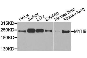 Western blot analysis of extracts of various cell lines, using MYH9 antibody. (Myosin 9 antibody  (AA 1711-1960))