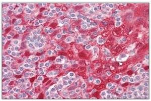 Human Tonsil: Formalin-Fixed, Paraffin-Embedded (FFPE) (CSTA antibody  (Internal Region))