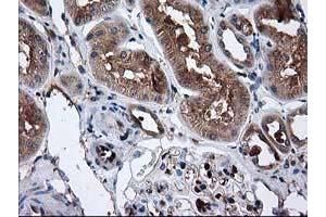 Immunohistochemical staining of paraffin-embedded Human Kidney tissue using anti-CAT mouse monoclonal antibody. (Catalase antibody)