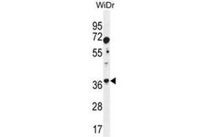 ALDOC Antibody (N-term) western blot analysis in WiDr cell line lysates (35 µg/lane). (ALDOC antibody  (N-Term))