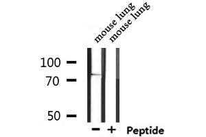 Western blot analysis of extracts from mouse lung, using SV2C Antibody. (SV2C antibody  (Internal Region))