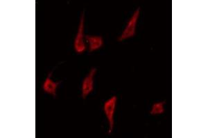 ABIN6267618 staining NIH-3T3 by IF/ICC. (PKC delta antibody  (pTyr313))