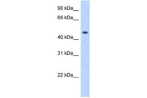 WB Suggested Anti-ZNF213 Antibody Titration:  0. (ZNF213 antibody  (Middle Region))