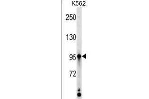 KAZ Antibody (C-term) (ABIN1537561 and ABIN2850222) western blot analysis in K562 cell line lysates (35 μg/lane).