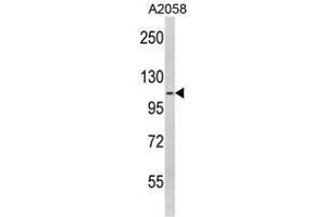Western blot analysis of SPINK5 Antibody (N-term) in A2058 cell line lysates (35ug/lane).