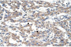 Human Heart (Deoxyuridine Triphosphatase (DUT) (C-Term) antibody)