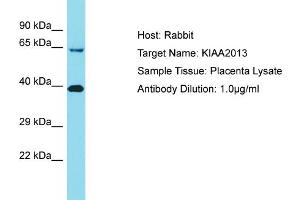 Host: Rabbit Target Name: KIAA2013 Sample Tissue: Human Placenta Antibody Dilution: 1ug/ml (KIAA2013 antibody  (C-Term))