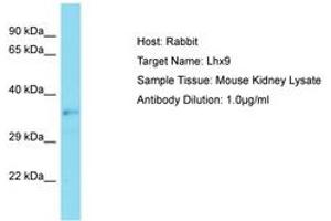Image no. 1 for anti-LIM Homeobox 9 (LHX9) (C-Term) antibody (ABIN6750259) (LHX9 antibody  (C-Term))