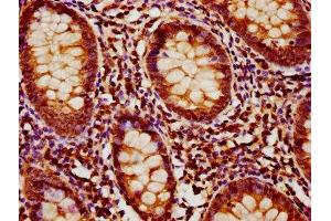 Immunohistochemistry (IHC) image for anti-MOB Kinase Activator 1B (MOB1B) (AA 2-216) antibody (ABIN7160120)