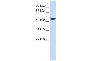 Western Blotting (WB) image for anti-Sphingomyelin Synthase 2 (SGMS2) antibody (ABIN2459623) (Sphingomyelin Synthase 2 antibody)
