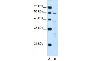 IL10R Alpha antibody used at 5 ug/ml to detect target protein. (IL-10RA antibody  (N-Term))