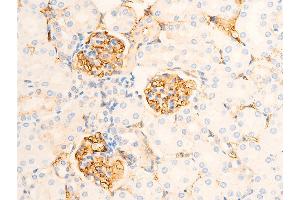 Immunohistochemistry (IHC) image for anti-Nuclear Factor of kappa Light Polypeptide Gene Enhancer in B-Cells Inhibitor, epsilon (NFKBIE) (pSer161) antibody (ABIN6255101)