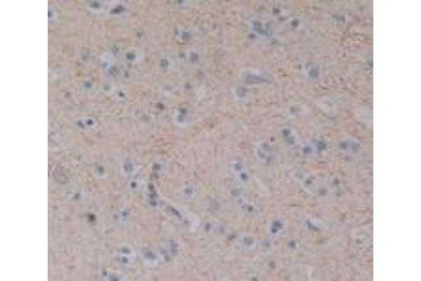 Substance P antibody