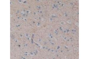 Detection of SP in Human Brain Tissue using Polyclonal Antibody to Substance P (SP) (Substance P antibody)