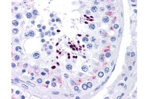 Immunohistochemistry (IHC) image for anti-Cyclin D1 (CCND1) (N-Term) antibody (ABIN2777893) (Cyclin D1 antibody  (N-Term))