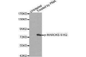 Western blot analysis of extracts from 293 cells, using Phospho-MARCKS-S162 antibody. (MARCKS antibody  (pSer162))