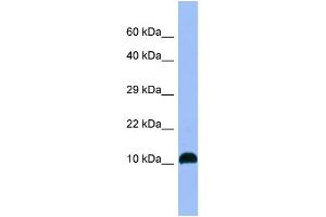 WB Suggested Anti-NPB Antibody Titration: 1. (Neuropeptide B antibody  (C-Term))