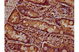 Immunohistochemistry (IHC) image for anti-Par-3 Partitioning Defective 3 Homolog (PARD3) (AA 1068-1356) antibody (ABIN7162659)